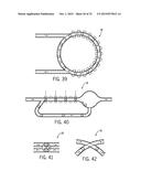 LOW SHEAR TRIM diagram and image