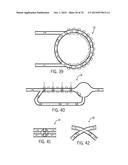 LOW SHEAR TRIM diagram and image