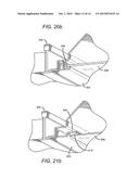 FRAME AND LENS UPGRADE KITS FOR LIGHTING FIXTURES diagram and image