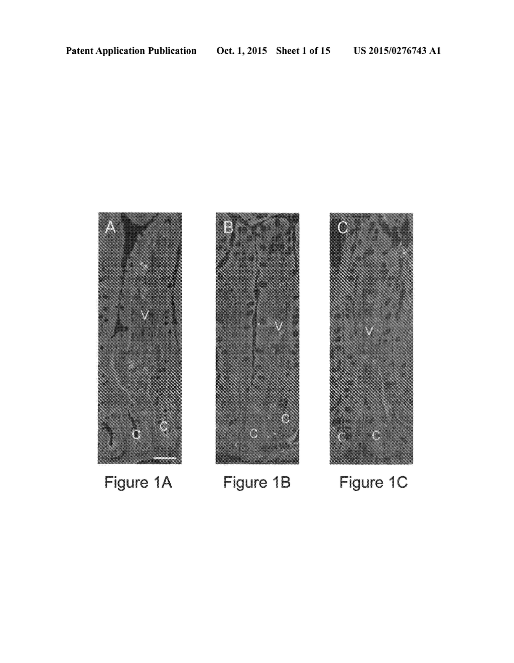 PROLIFERATION-ASSOCIATED MODULATION OF THE SPLICING OF THE INTEGRIN ALPHA     6 ISOFORMS - diagram, schematic, and image 02