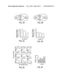 SYSTEMS AND METHODS FOR IDENTIFYING CANCERS HAVING ACTIVATED PROGESTERONE     RECEPTORS diagram and image