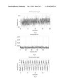 LARGE-CALIBER TELESCOPE NON-LINEAR INTERFERENCE DETECTING AND FILTERING     METHOD diagram and image