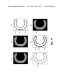 REDUCING HALO ARTIFACTS IN ELECTROPHOTOGRAPHIC PRINTING SYSTEMS diagram and image