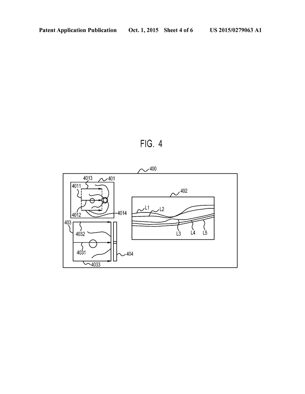 TOMOGRAPHIC IMAGE PROCESSING APPARATUS, TOMOGRAPHIC IMAGE PROCESSING     METHOD AND PROGRAM - diagram, schematic, and image 05