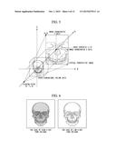 IMAGE PROCESSOR, TREATMENT SYSTEM, AND IMAGE PROCESSING METHOD diagram and image