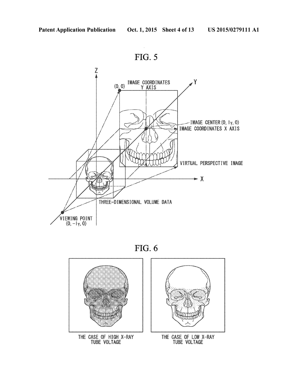 IMAGE PROCESSOR, TREATMENT SYSTEM, AND IMAGE PROCESSING METHOD - diagram, schematic, and image 05