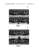 TILING IN VIDEO ENCODING AND DECODING diagram and image