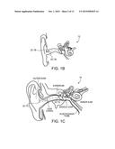 EARPIECES HAVING FLEXIBLE FLAPS diagram and image