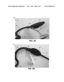 AUDIO HEADSET HAVING WIRE GUIDED EAR BUDS diagram and image