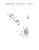 TRANSCUTANEOUS ANALYTE SENSOR diagram and image