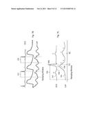 METHODS AND SYSTEMS FOR EXTRACTING VENOUS PULSATION AND RESPIRATORY     INFORMATION FROM PHOTOPLETHYSMOGRAPHS diagram and image