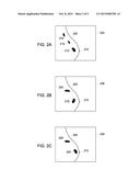 SYSTEM AND METHOD FOR DETECTION OF LESIONS diagram and image