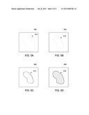 SYSTEM AND METHOD FOR DETECTION OF LESIONS diagram and image