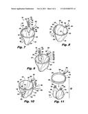 SURGICAL RETRIEVAL APPARATUS diagram and image