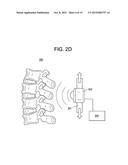 METHODS AND DEVICES FOR SPINAL CORRECTION diagram and image