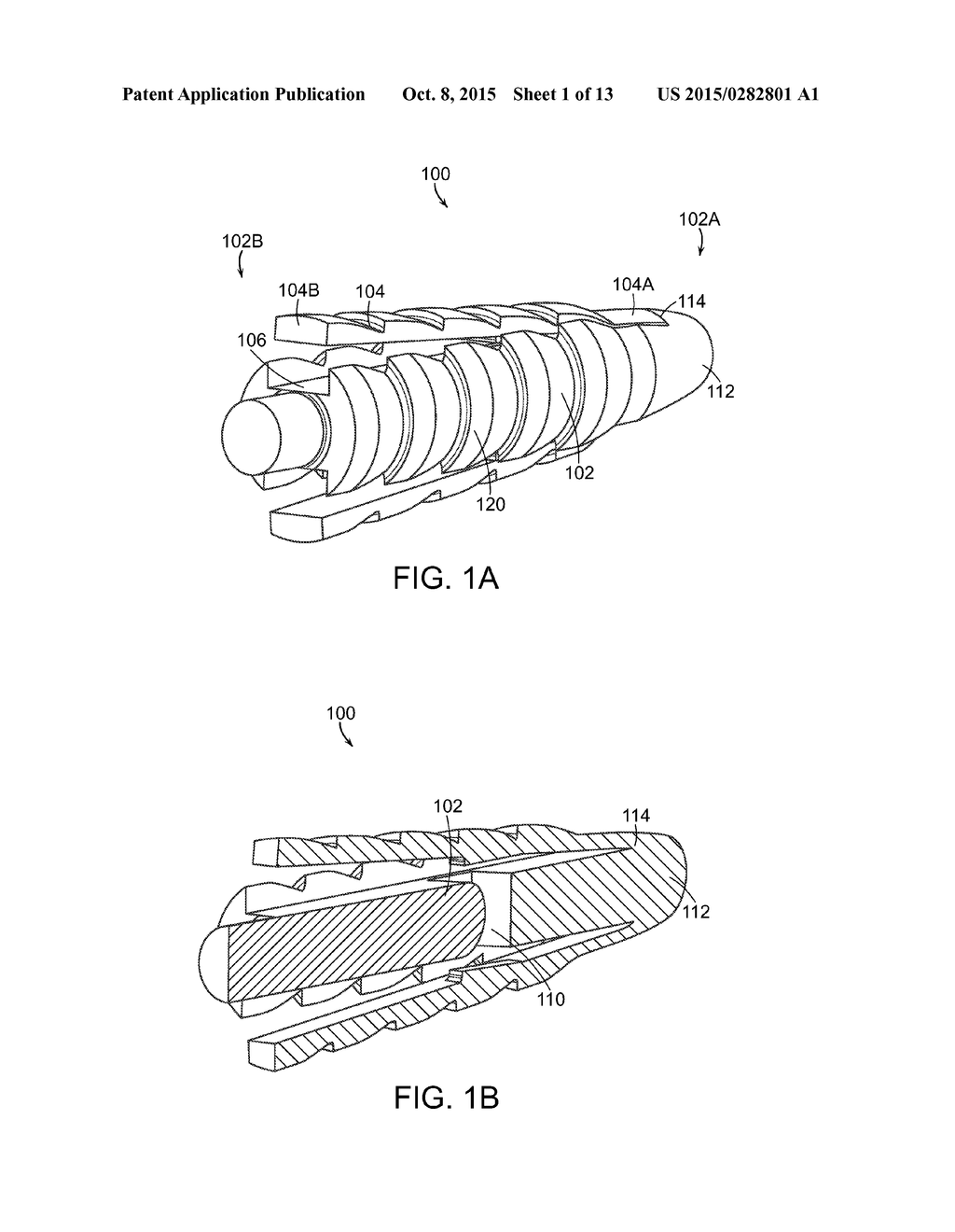 KNOTLESS ANCHOR - diagram, schematic, and image 02