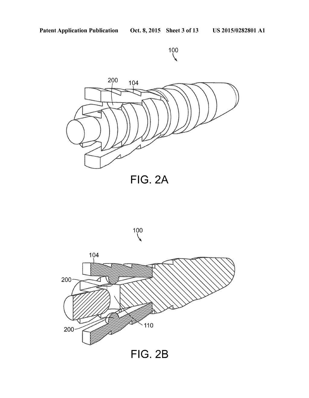 KNOTLESS ANCHOR - diagram, schematic, and image 04