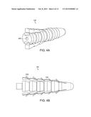 KNOTLESS ANCHOR diagram and image