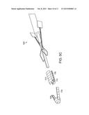 KNOTLESS ANCHOR diagram and image