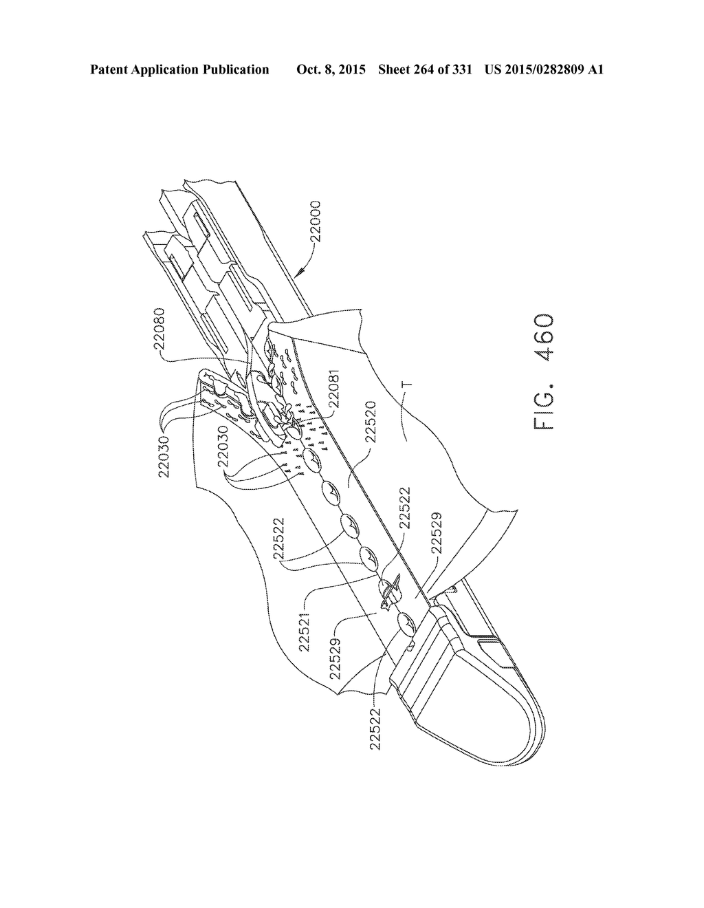 RETAINER ASSEMBLY INCLUDING A TISSUE THICKNESS COMPENSATOR - diagram, schematic, and image 265