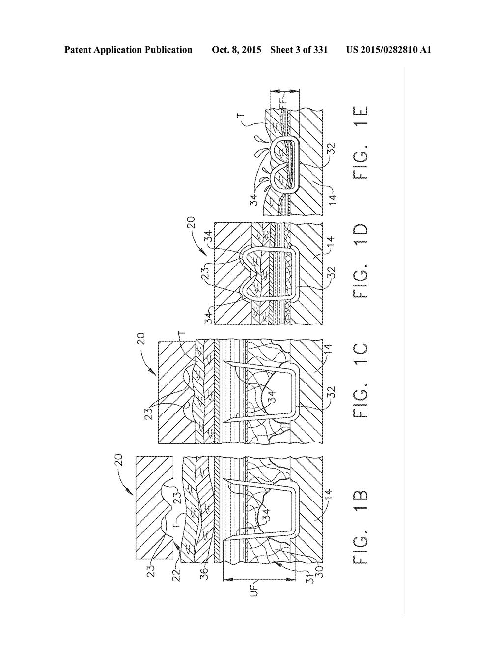 RETAINER ASSEMBLY INCLUDING A TISSUE THICKNESS COMPENSATOR - diagram, schematic, and image 04