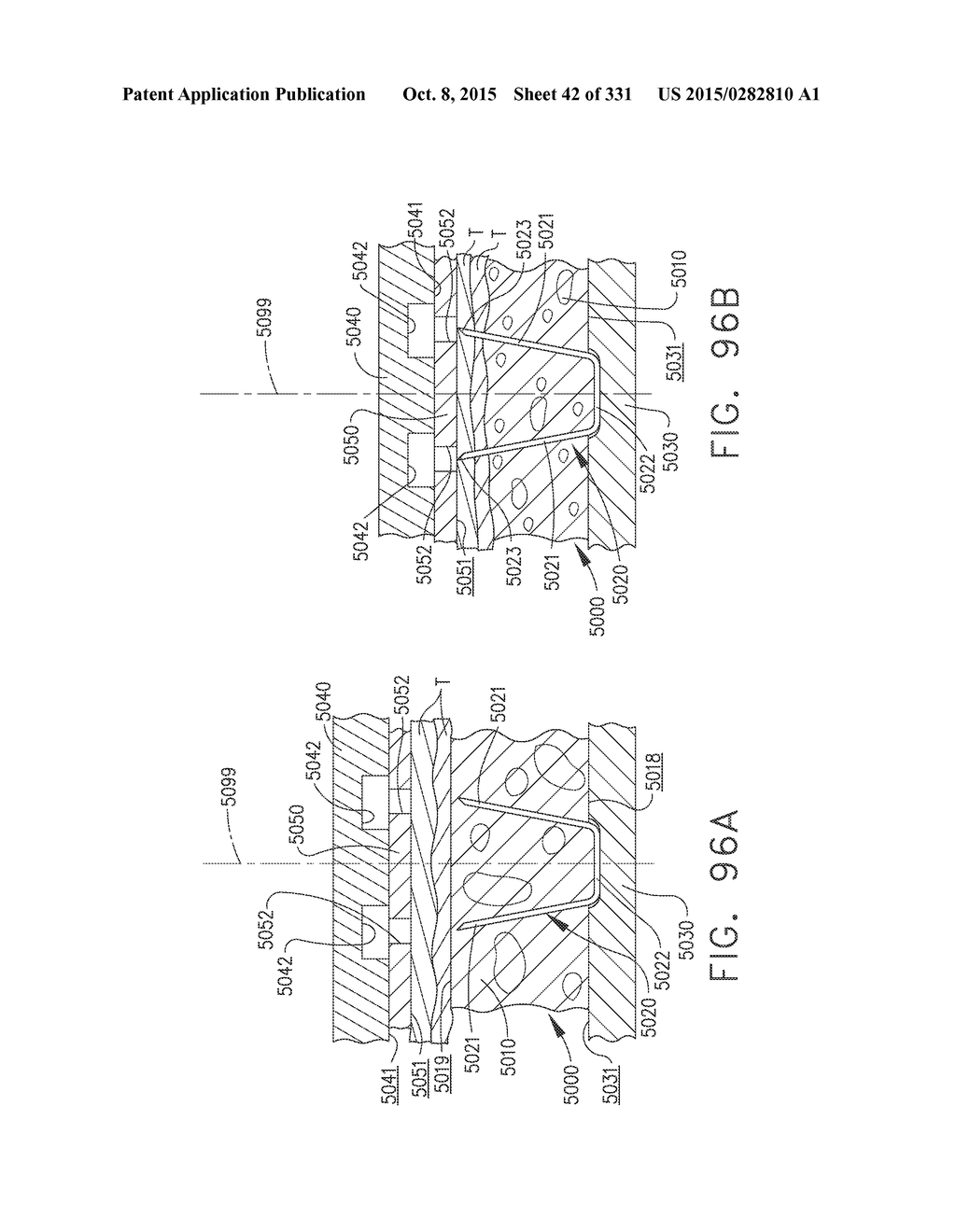 RETAINER ASSEMBLY INCLUDING A TISSUE THICKNESS COMPENSATOR - diagram, schematic, and image 43