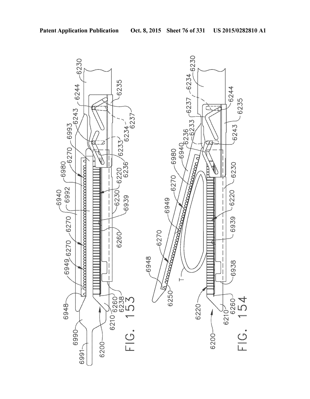 RETAINER ASSEMBLY INCLUDING A TISSUE THICKNESS COMPENSATOR - diagram, schematic, and image 77