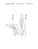 DEVICE FOR ASSISTING IN FLEXOR TENDON REPAIR AND REHABILITATION diagram and image