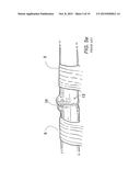 DEVICE FOR ASSISTING IN FLEXOR TENDON REPAIR AND REHABILITATION diagram and image