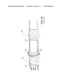 DEVICE FOR ASSISTING IN FLEXOR TENDON REPAIR AND REHABILITATION diagram and image