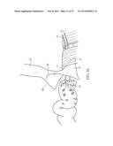 DEVICE FOR ASSISTING IN FLEXOR TENDON REPAIR AND REHABILITATION diagram and image