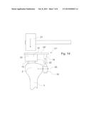 BONE CHISEL AND METHOD FOR WORKING A TIBIA HEAD diagram and image