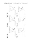 COLLECTING AND HARVESTING CUT BONE FROM KERRISON RONGEUR diagram and image