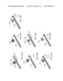 COLLECTING AND HARVESTING CUT BONE FROM KERRISON RONGEUR diagram and image