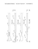 ULTRASONIC SURGICAL INSTRUMENT BLADES diagram and image