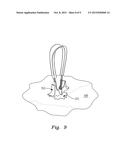 Cranial Burr Hole Cover diagram and image