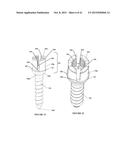 Polyaxial Plate Rod System and Surgical Procedure diagram and image