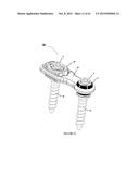 Polyaxial Plate Rod System and Surgical Procedure diagram and image