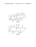 Polyaxial Plate Rod System and Surgical Procedure diagram and image