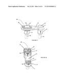 Polyaxial Plate Rod System and Surgical Procedure diagram and image