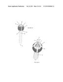 Polyaxial Plate Rod System and Surgical Procedure diagram and image