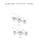 Polyaxial Plate Rod System and Surgical Procedure diagram and image