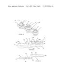 Polyaxial Plate Rod System and Surgical Procedure diagram and image