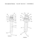 Polyaxial Plate Rod System and Surgical Procedure diagram and image