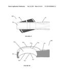 Polyaxial Plate Rod System and Surgical Procedure diagram and image