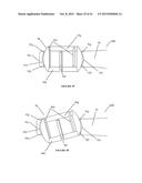 Polyaxial Plate Rod System and Surgical Procedure diagram and image