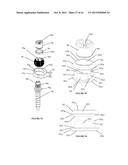 Polyaxial Plate Rod System and Surgical Procedure diagram and image