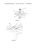 Polyaxial Plate Rod System and Surgical Procedure diagram and image