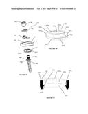 Polyaxial Plate Rod System and Surgical Procedure diagram and image