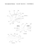 Polyaxial Plate Rod System and Surgical Procedure diagram and image